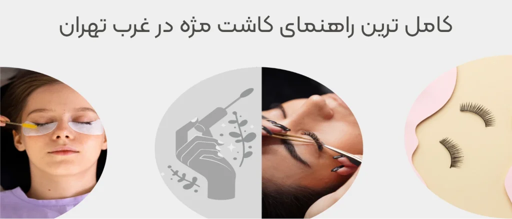 کاشت مژه در غرب تهران
